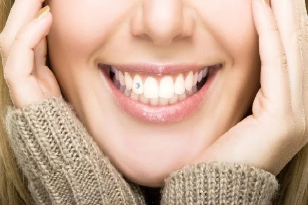 Tooth Jewellery